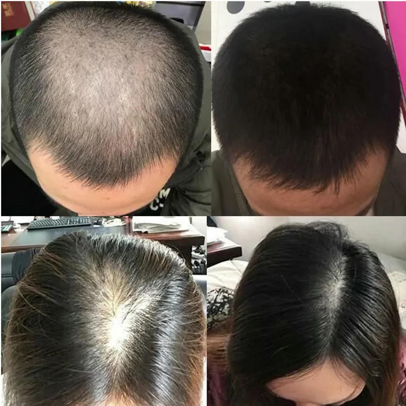 Overlord Plant Hair Growth Liq - đánh giá và giá Hair Care Or Haircare