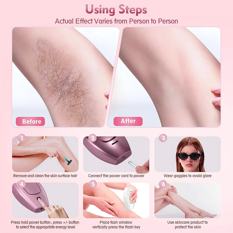 IPL laser Hair Remover Hair Cu - đánh giá và giá Hair Care Or Haircare